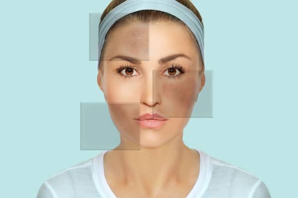 Put Your Best Skin Forward